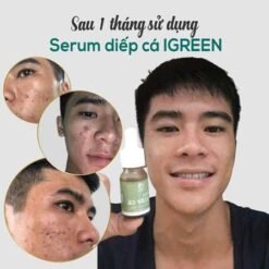 serum trị mụn diếp cá igreen